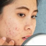 Skin Care Tips: चेहरे पर भूलकर भी न लगाए यें घरेलू चीजें, डैमेज हो सकती है स्किन